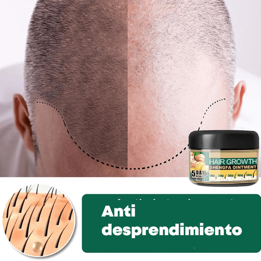 HAIR GROWTH PRO® - Crema de Jengibre Para Crecimiento Capilar